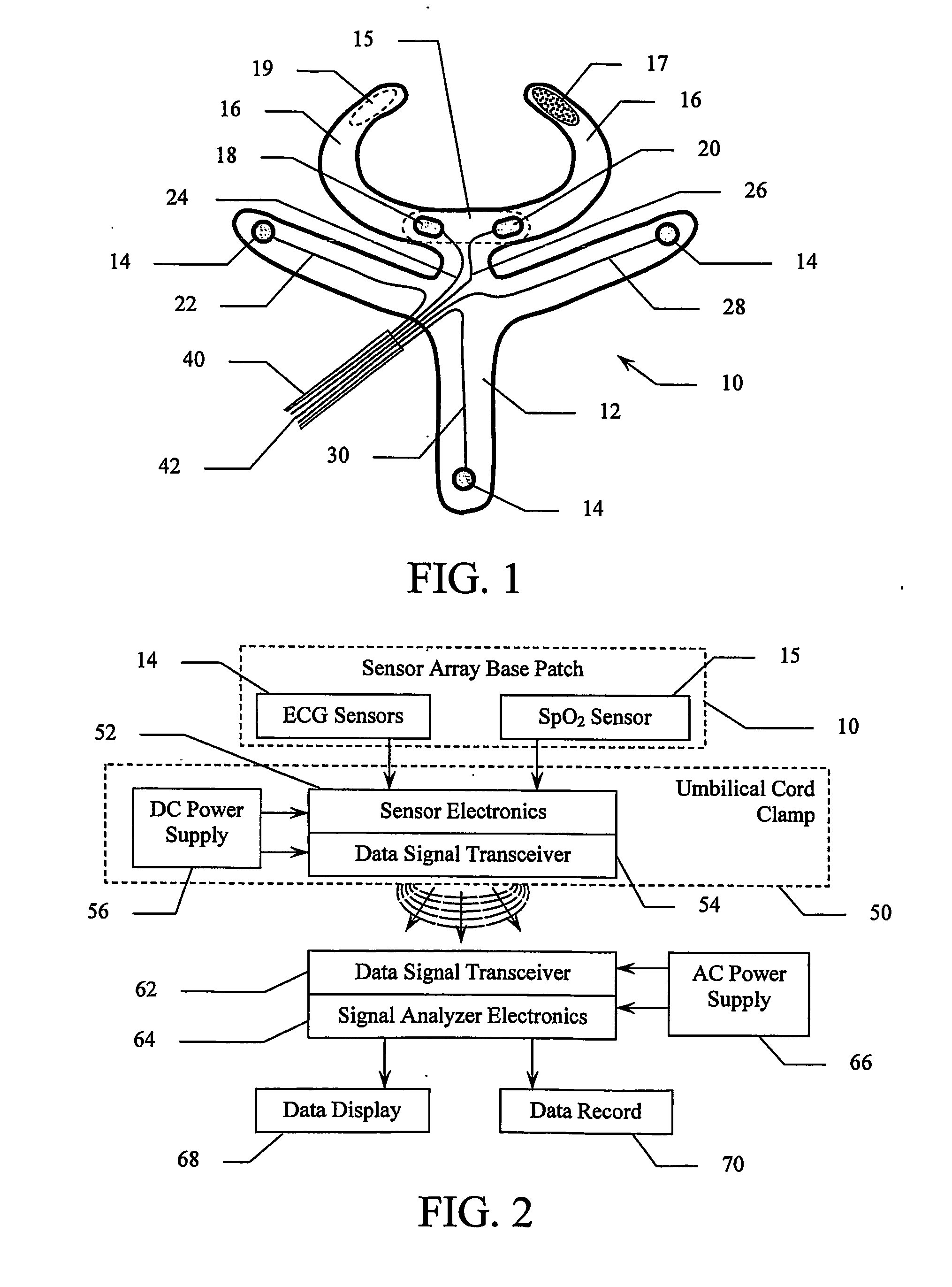 Periumbilical Infant Ecg Sensor and Monitoring System