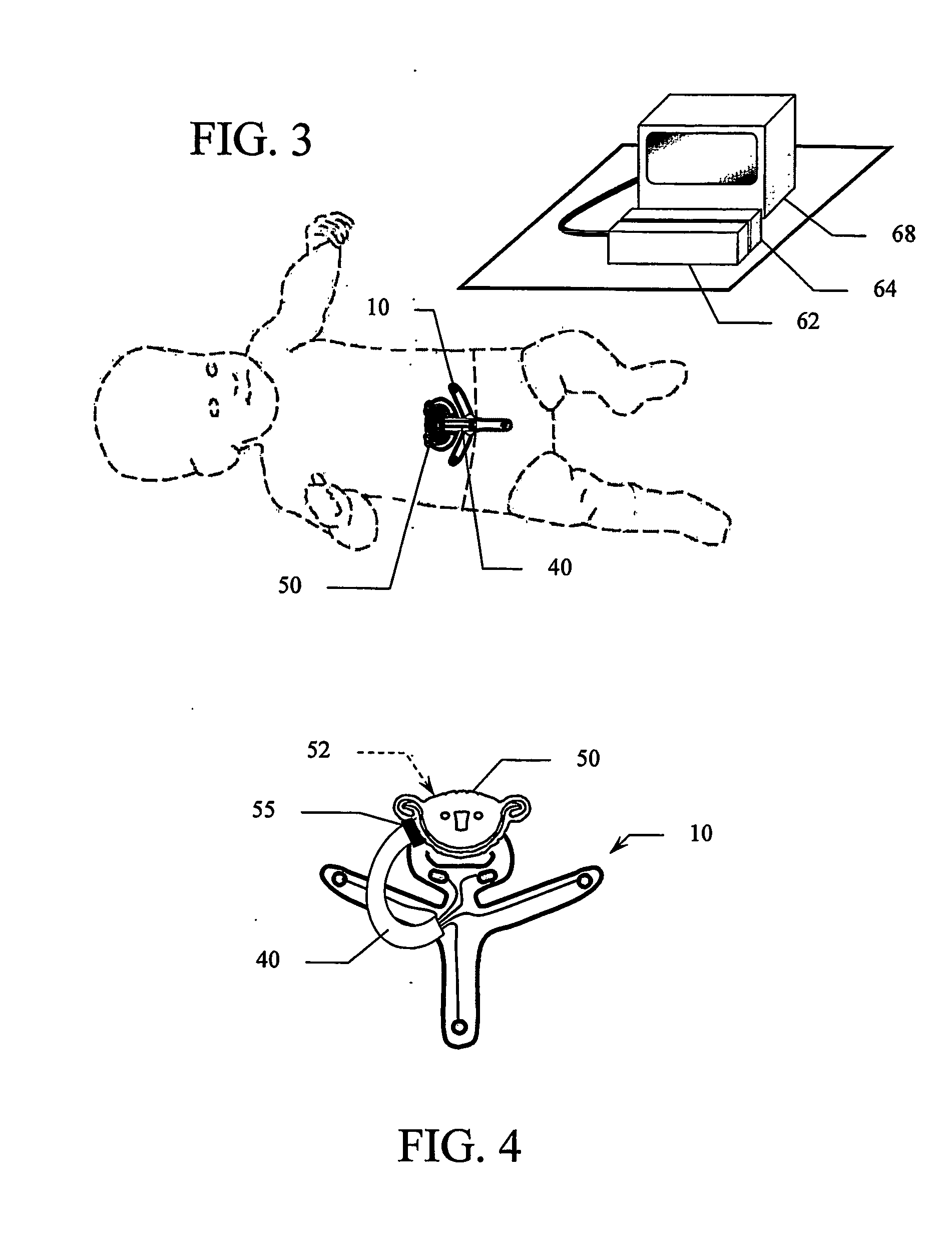 Periumbilical Infant Ecg Sensor and Monitoring System