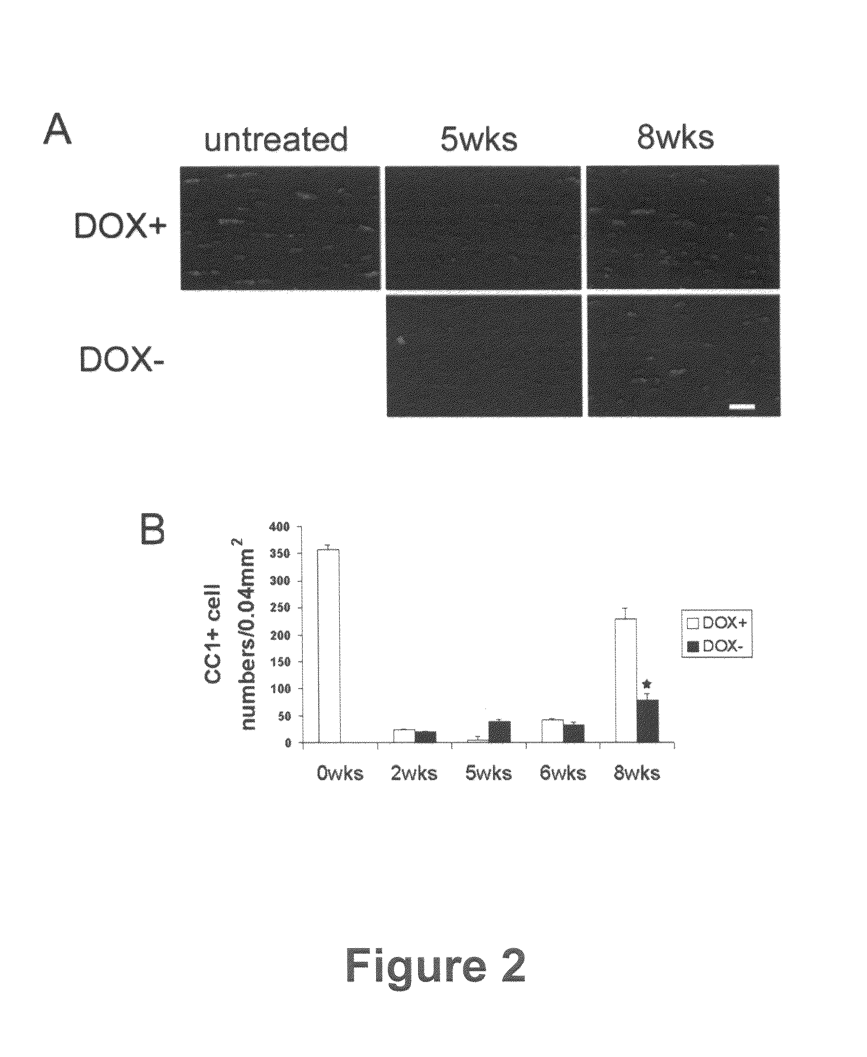 Methods for treating demyelination disorders