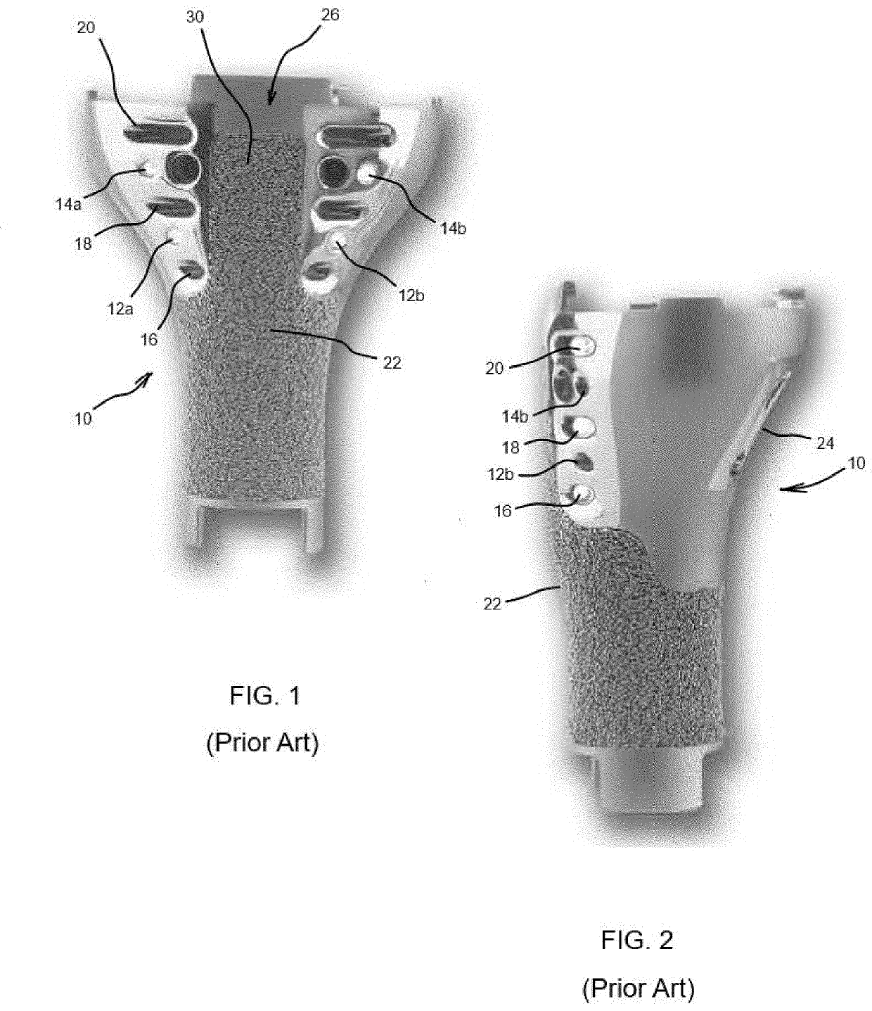 Systems and methods for attaching soft tissue to an implant