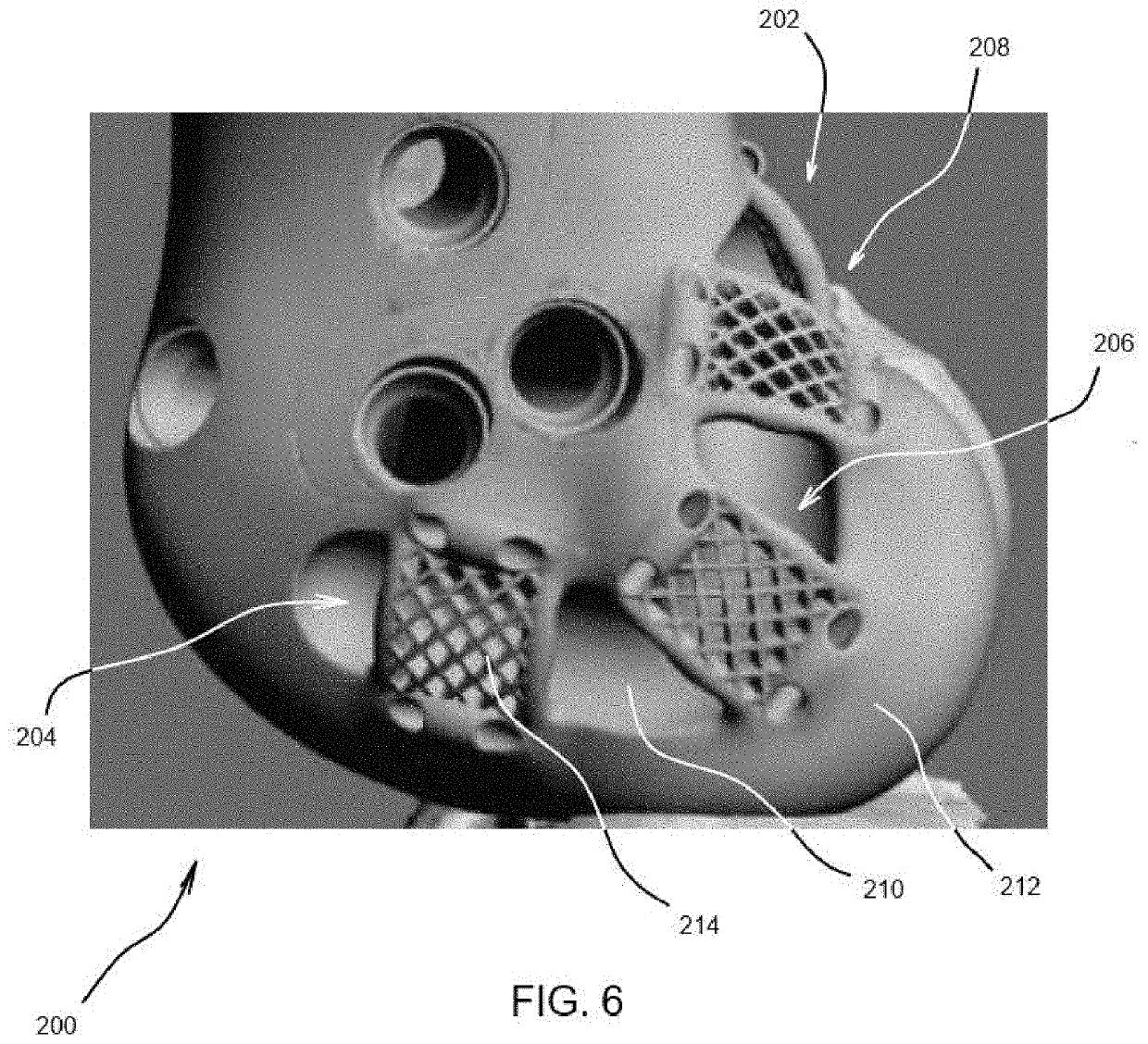 Systems and methods for attaching soft tissue to an implant