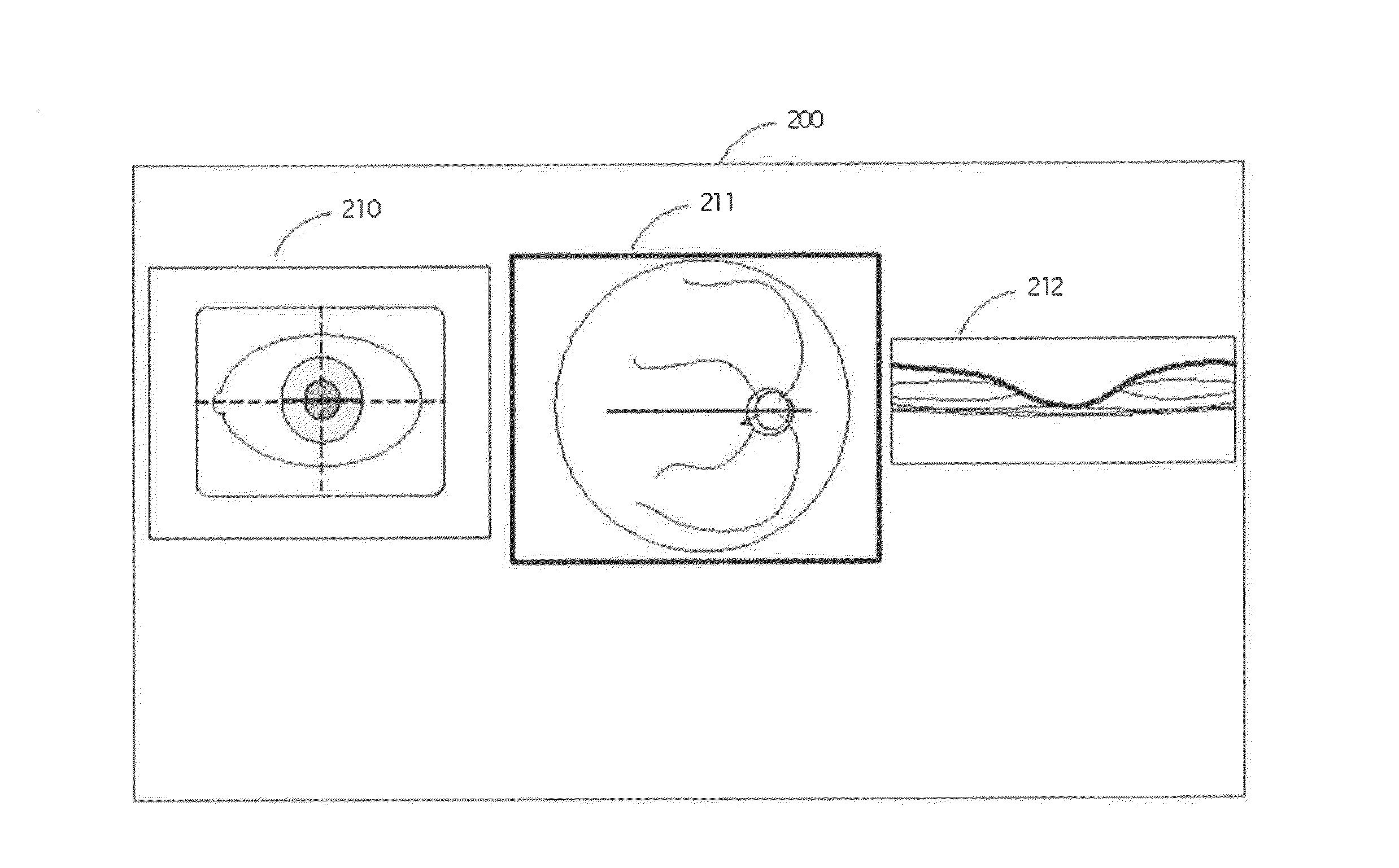 Retinal movement tracking in optical coherence tomography