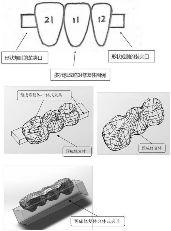 Implant immediate restoration method, device and system for preformed temporary restoration