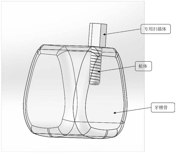 Implant immediate restoration method, device and system for preformed temporary restoration