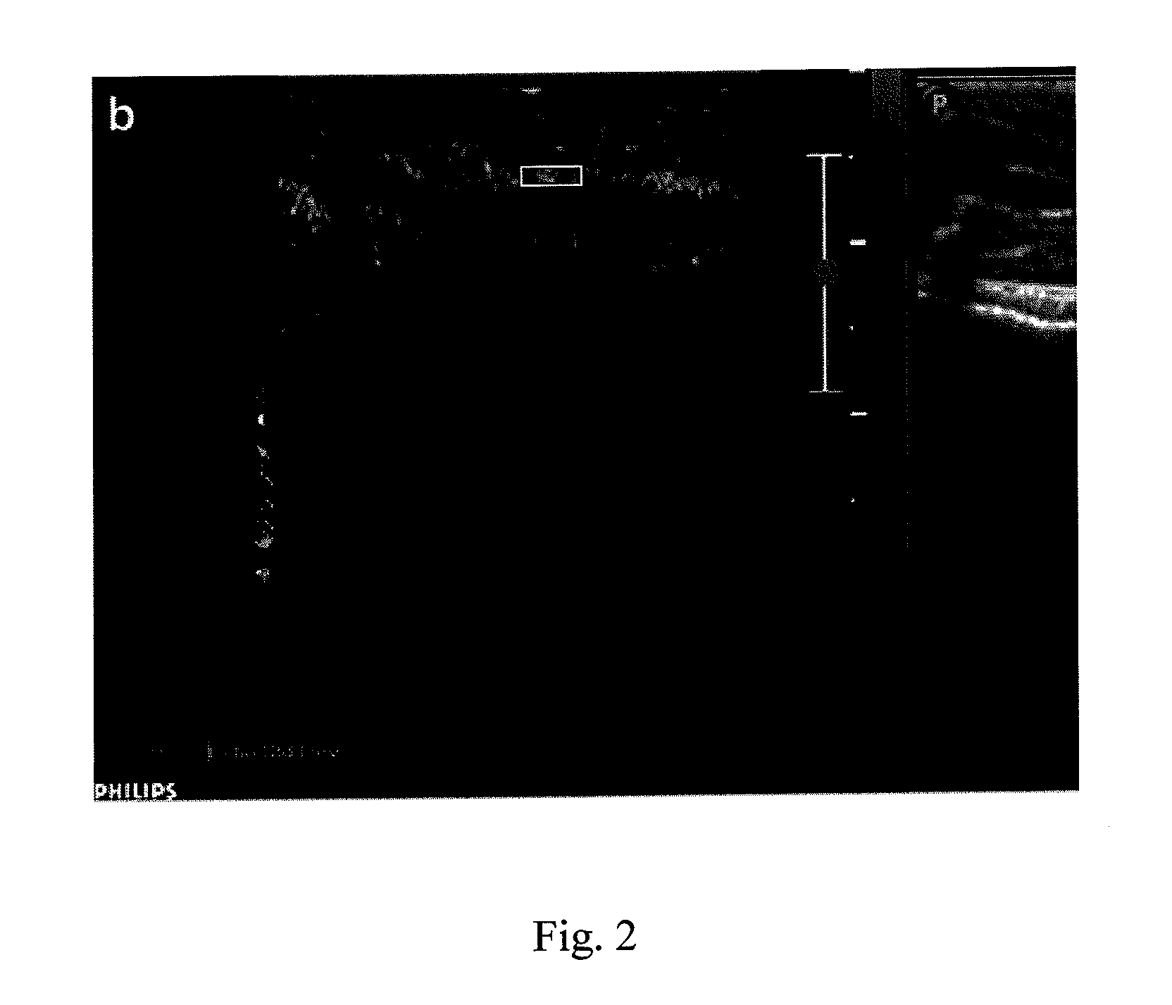 Method for quantifying drug delivery using contrast-enhanced ultrasound