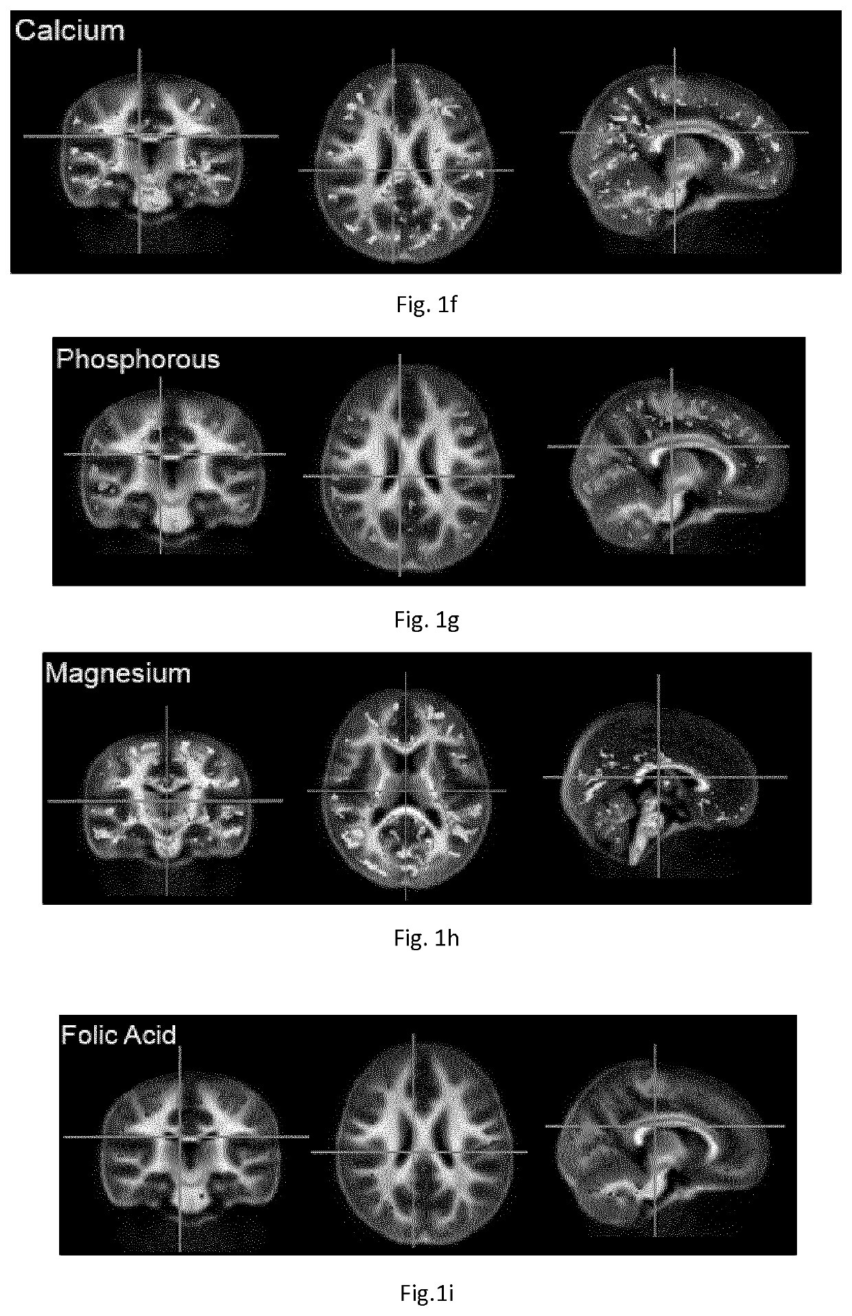 Nutritional compositions and infant formula for promoting de novo myealination