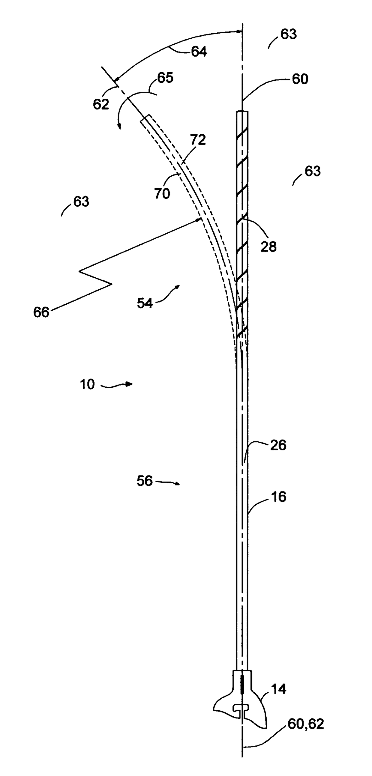 Bend limiting access sheath