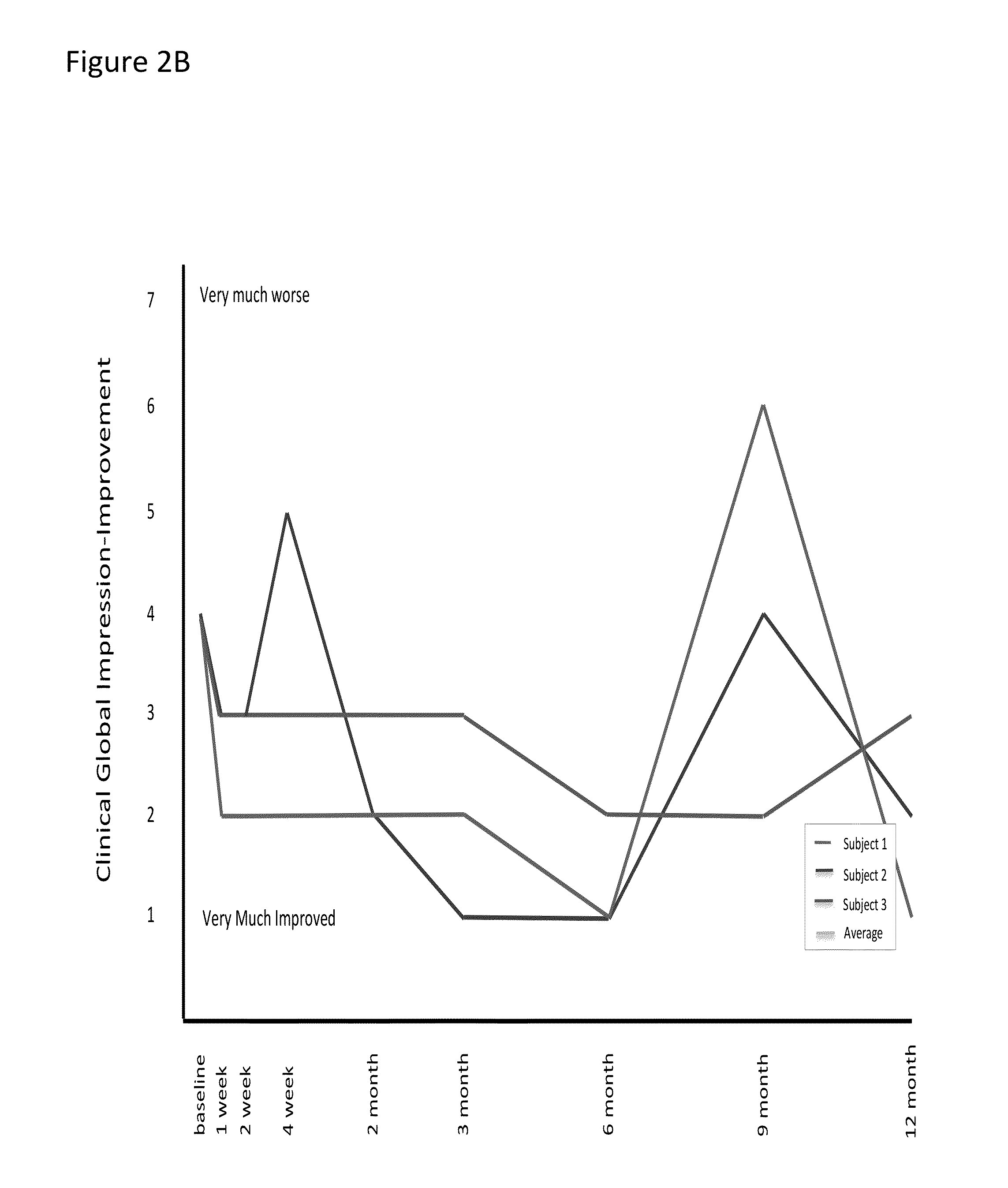 Treatment of refractory neuropsychiatric disorders using targeted radiation