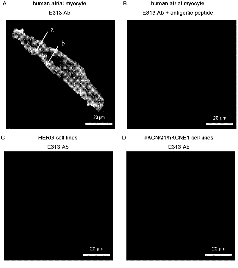 Immunogenic peptide of human voltage-gated potassium channel 1.5 (hKv1.5) and purpose thereof