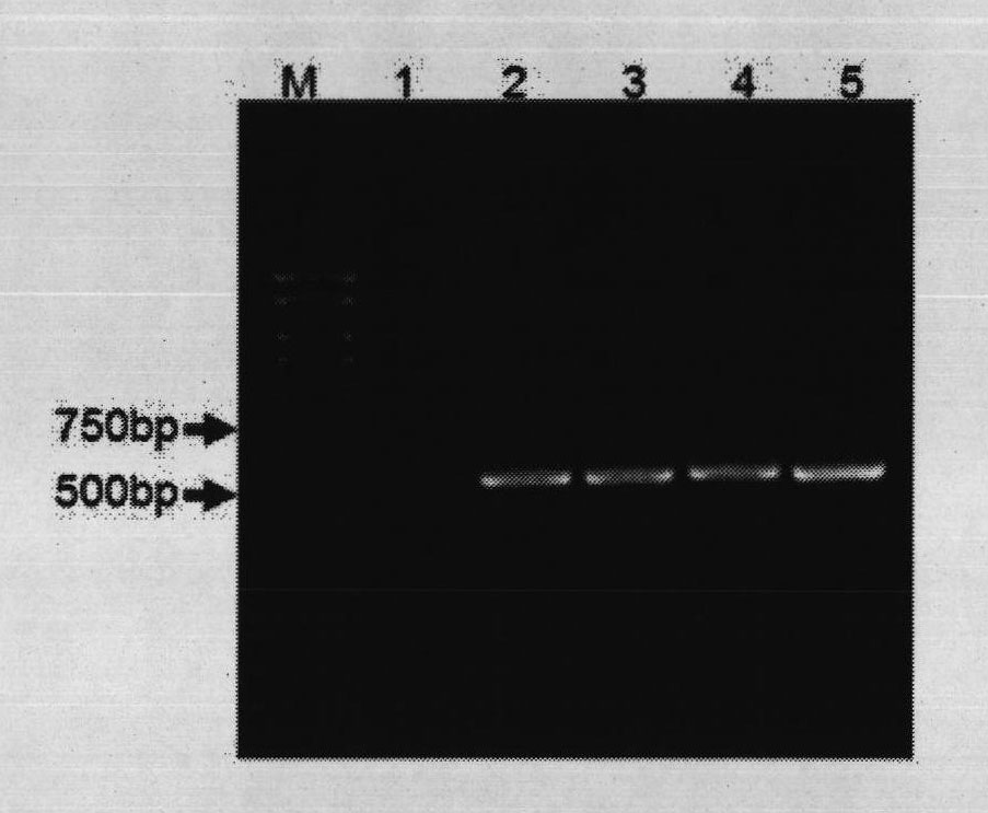 Method for identifying bifidobactirium