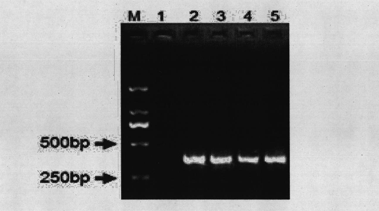 Method for identifying bifidobactirium