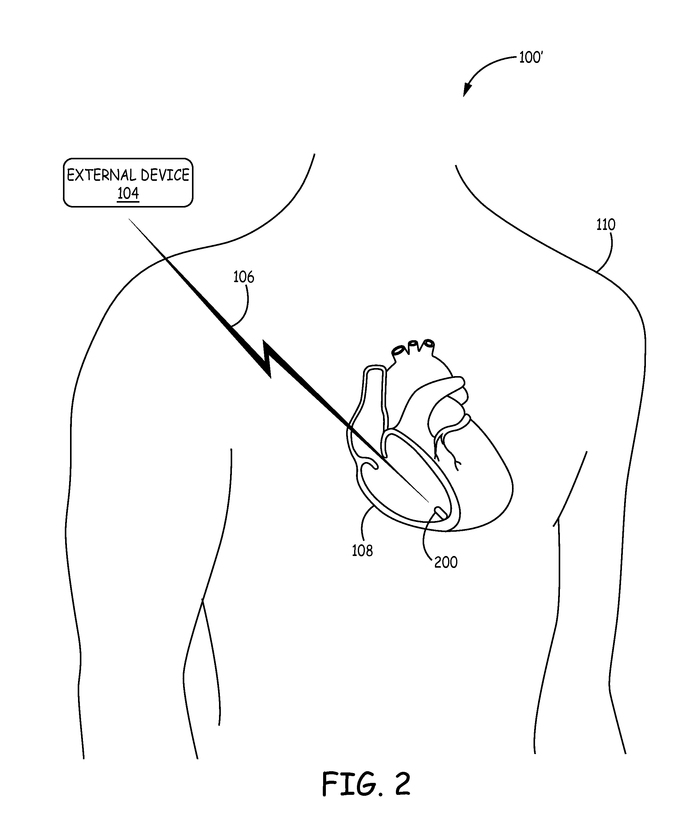 Implantable medical devices having cofire ceramic modules and methods of fabricating the same