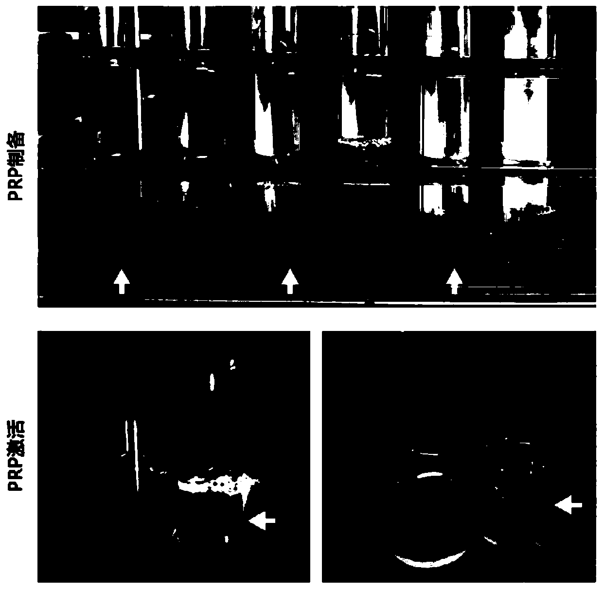 A method for preparing platelet-rich plasma without exogenous additives