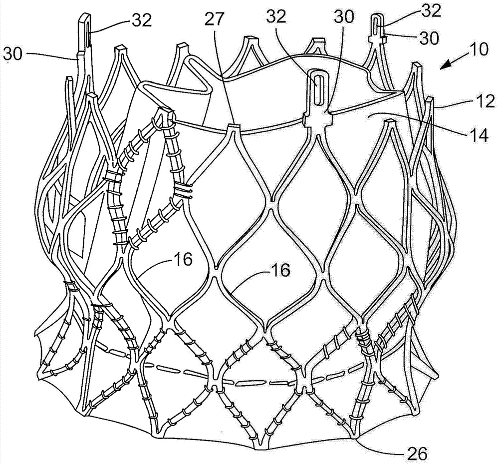 Prosthetic heart valve delivery apparatus