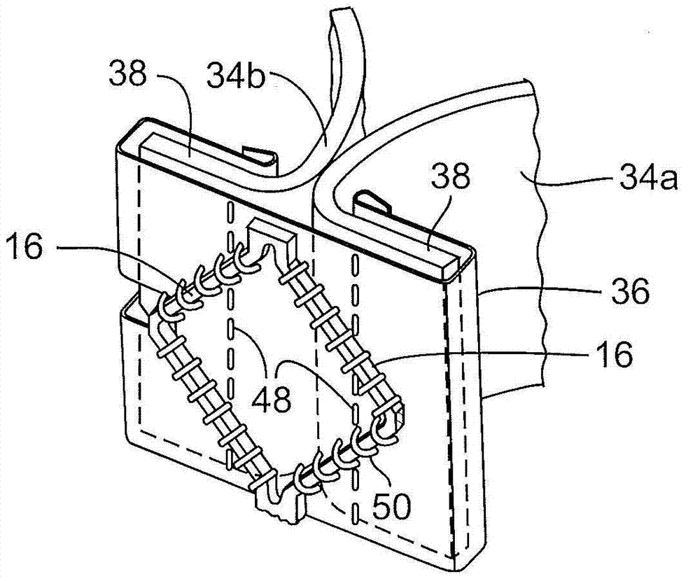 Prosthetic heart valve delivery apparatus