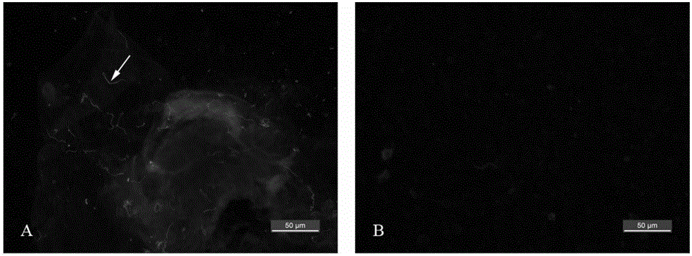 B.garinii polyclonal antibody and application