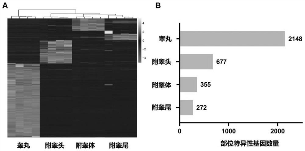 Kit for evaluating azoospermia before operation based on seminal plasma exosome mRNA expression profile