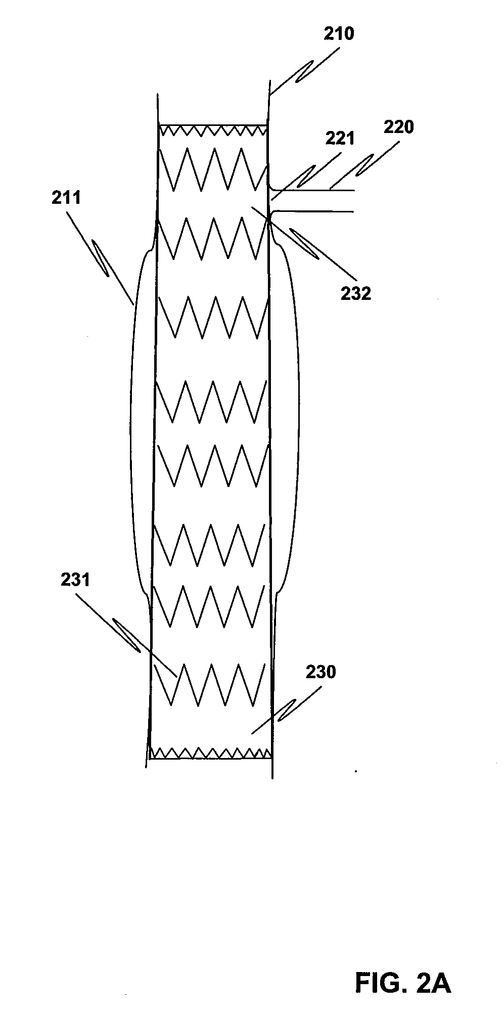 Method and Structure for Ameliorating Side-Effects of Performing in Situ Fenestration Using a Plasma RF Catheter