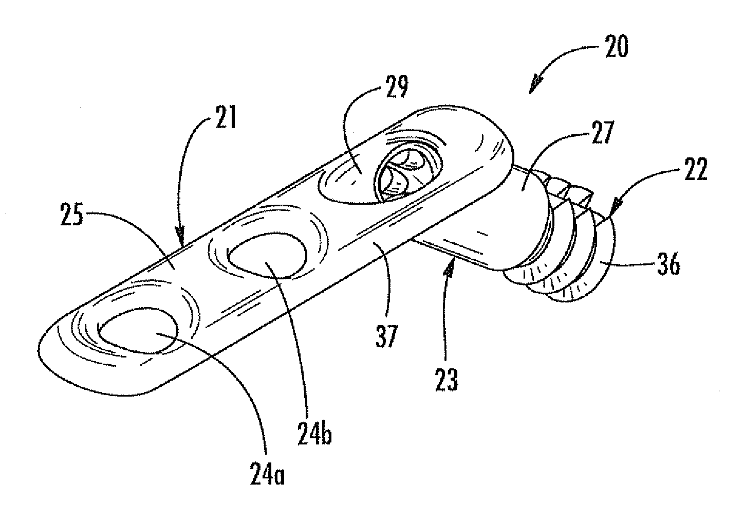 Arthrodesis implant for finger joints and related methods