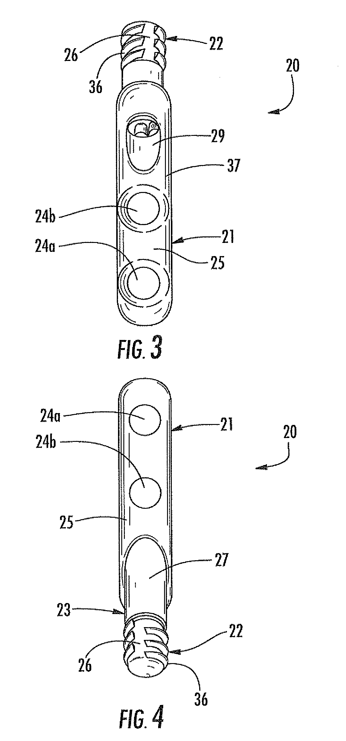 Arthrodesis implant for finger joints and related methods