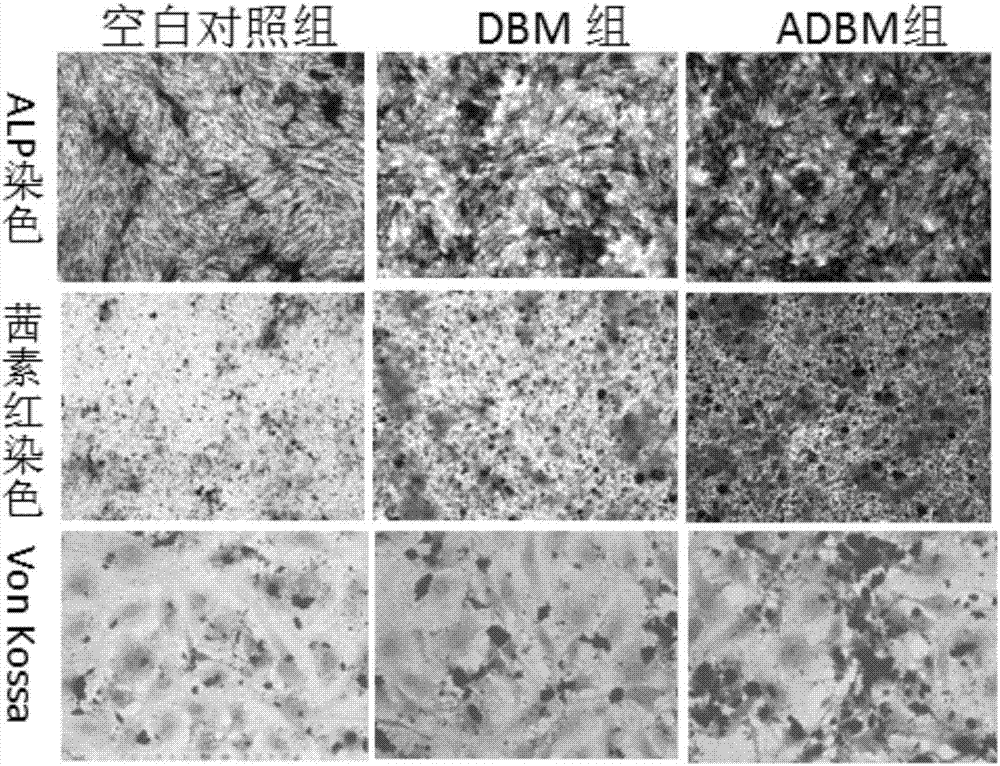 Preparation method of decalcified bone matrix bone-repairing material