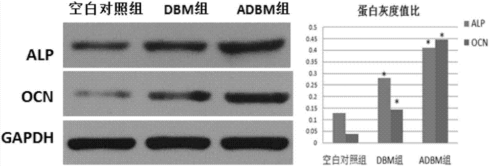 Preparation method of decalcified bone matrix bone-repairing material