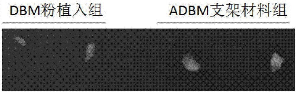 Preparation method of decalcified bone matrix bone-repairing material