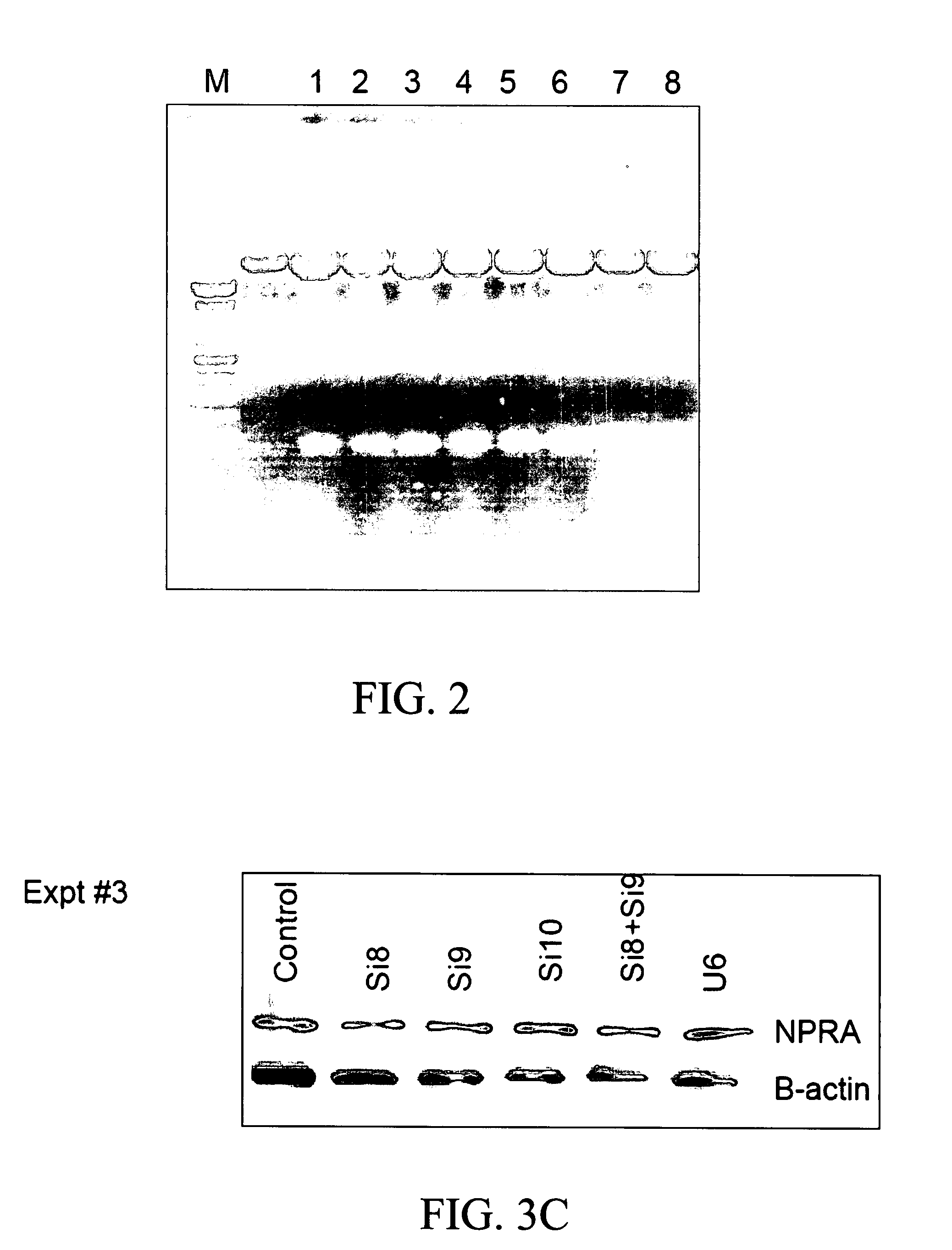 Materials and methods for reducing inflammation by inhibition of the atrial natriuretic peptide receptor