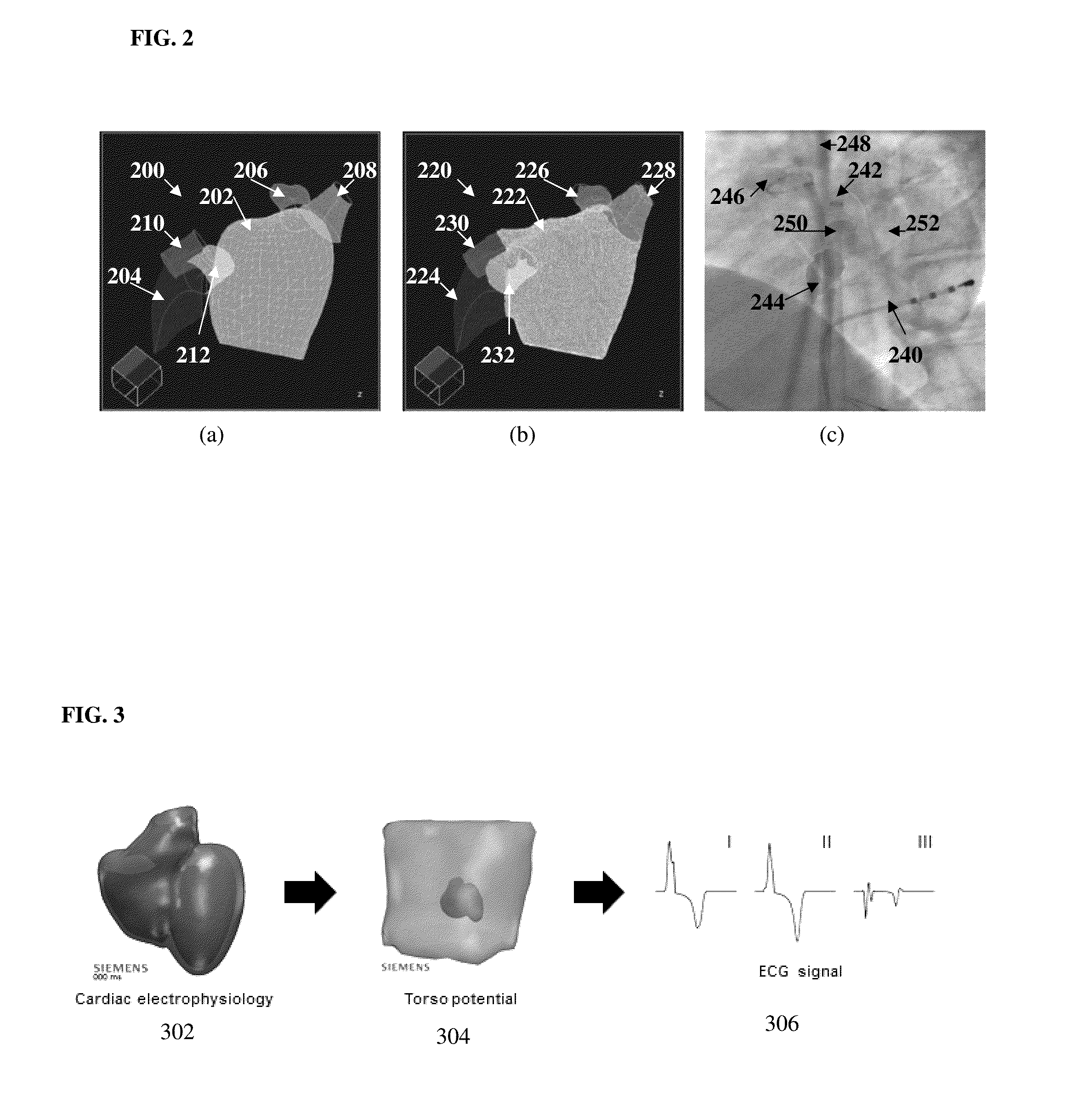 System and Method for Patient-Specific Image-Based Simulation of Artial Electrophysiology