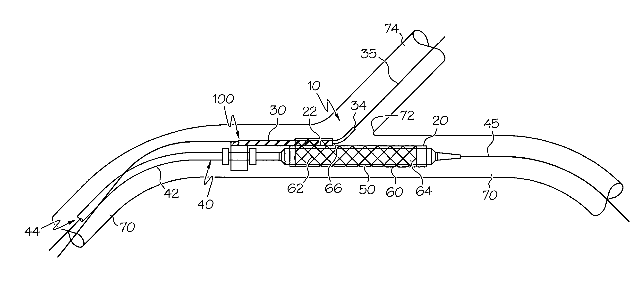 Rotatable sheath, assembly and method of manufacture of same