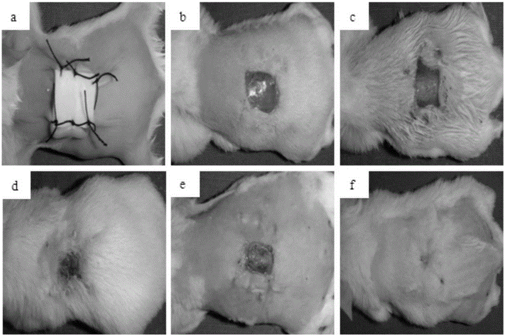 A kind of porous silicone rubber/polyurethane double-layer artificial skin containing nano-silver and its preparation method