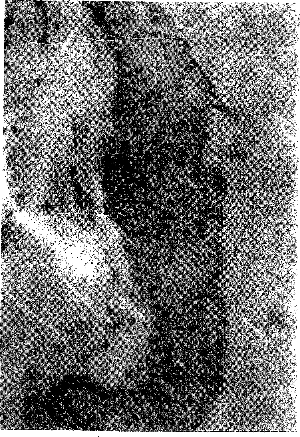 Nonoxynol nonylphenoxy-polyethoxyethanol suppositorium and preparation method thereof