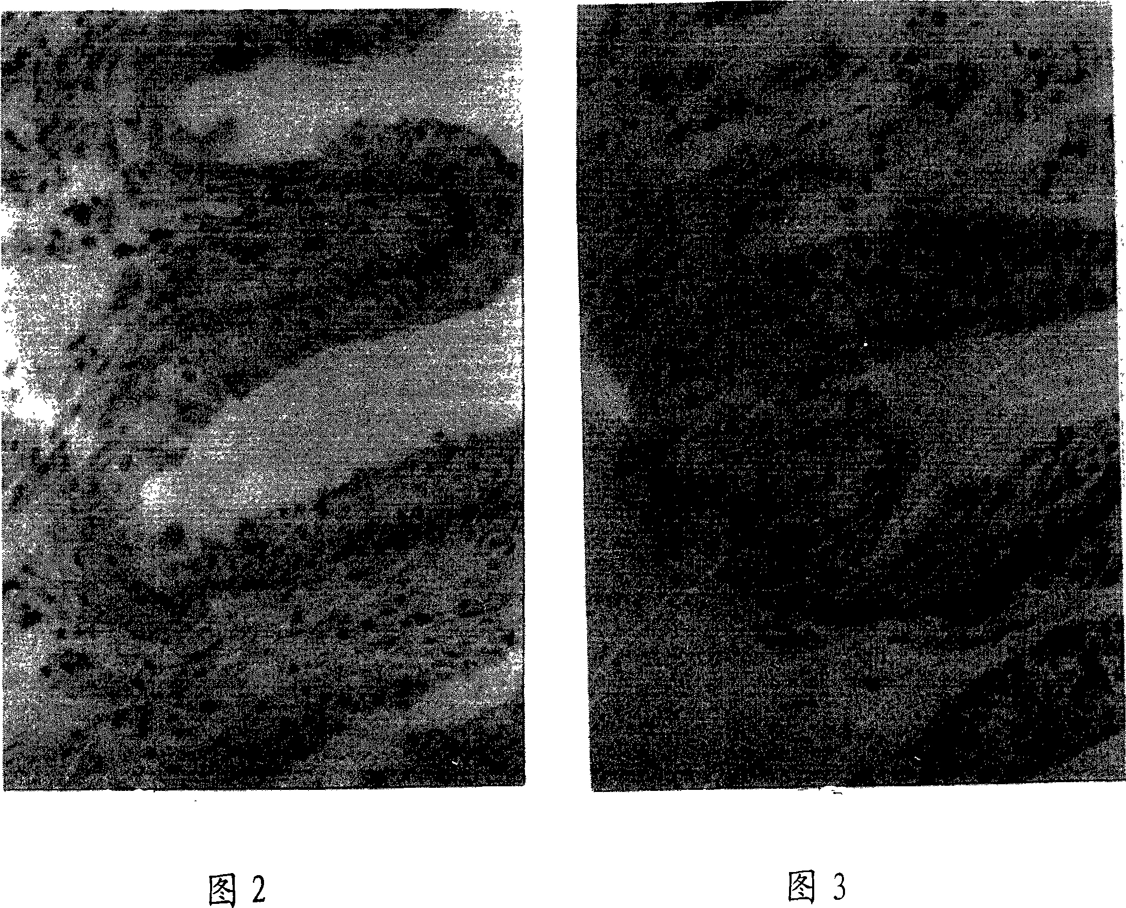 Nonoxynol nonylphenoxy-polyethoxyethanol suppositorium and preparation method thereof