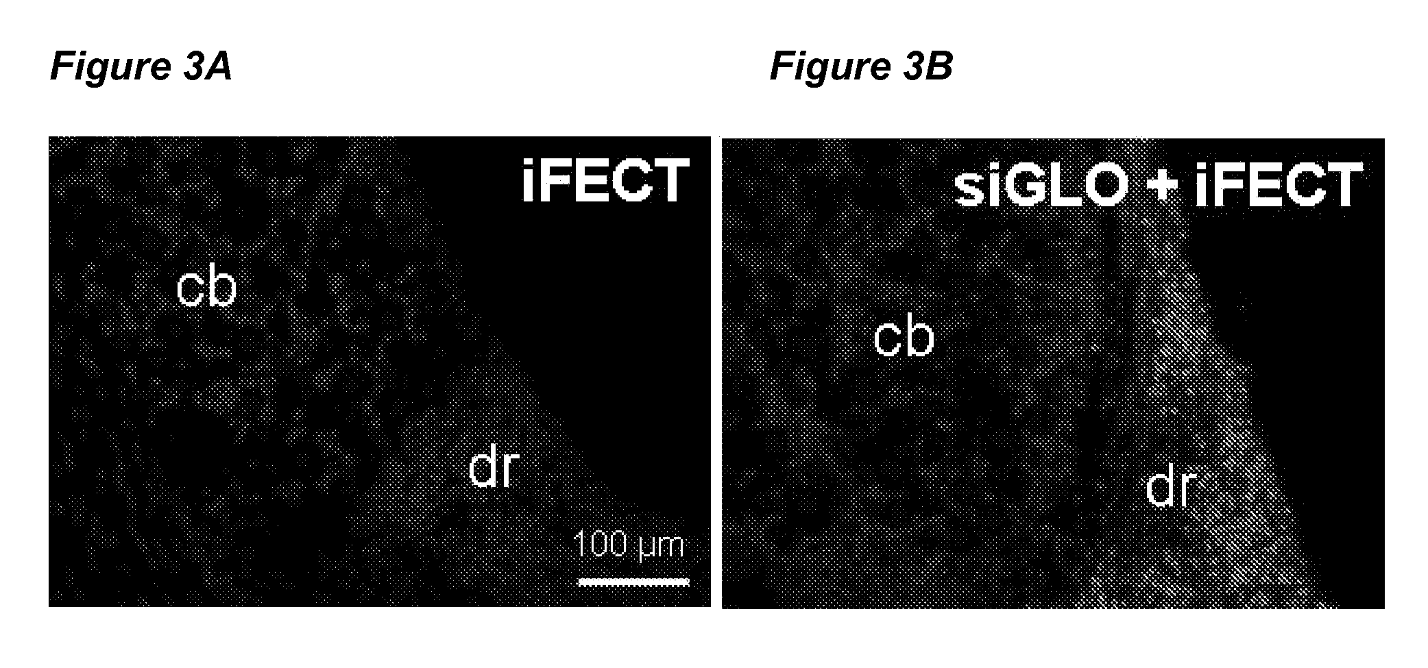 Suppression of SCN9A gene expression and/or function for the treatment of pain