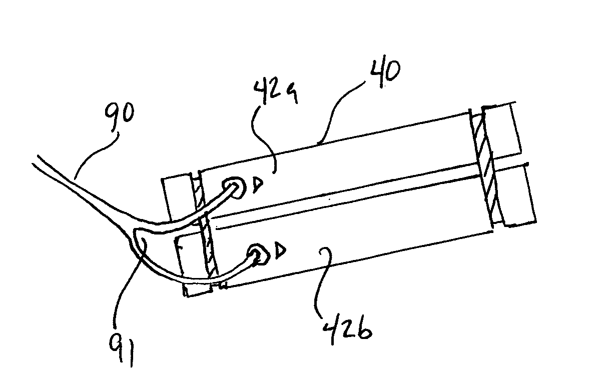 Method and apparatus for partioning an organ within the body