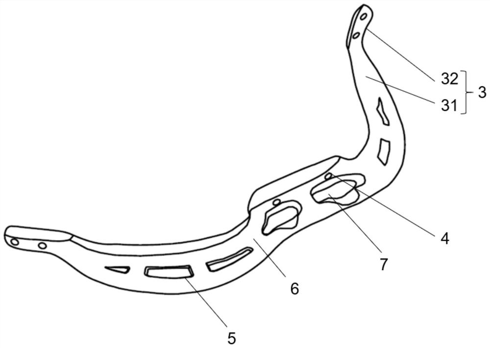 Jaw bone transplantation in-place guide plate