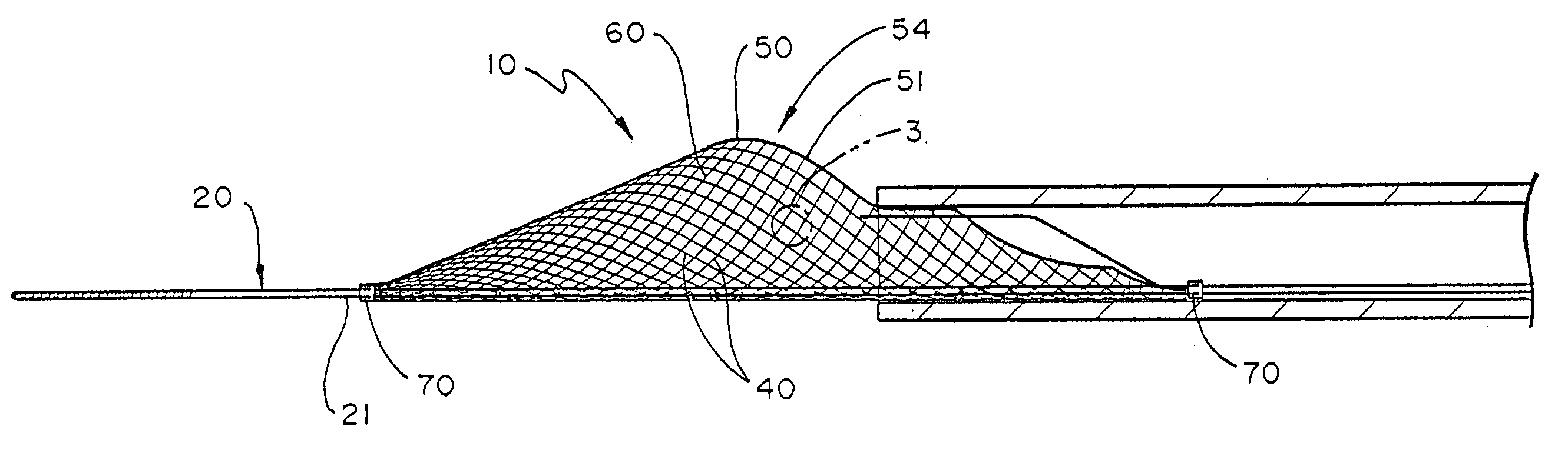 Radiopaque distal embolic protection device