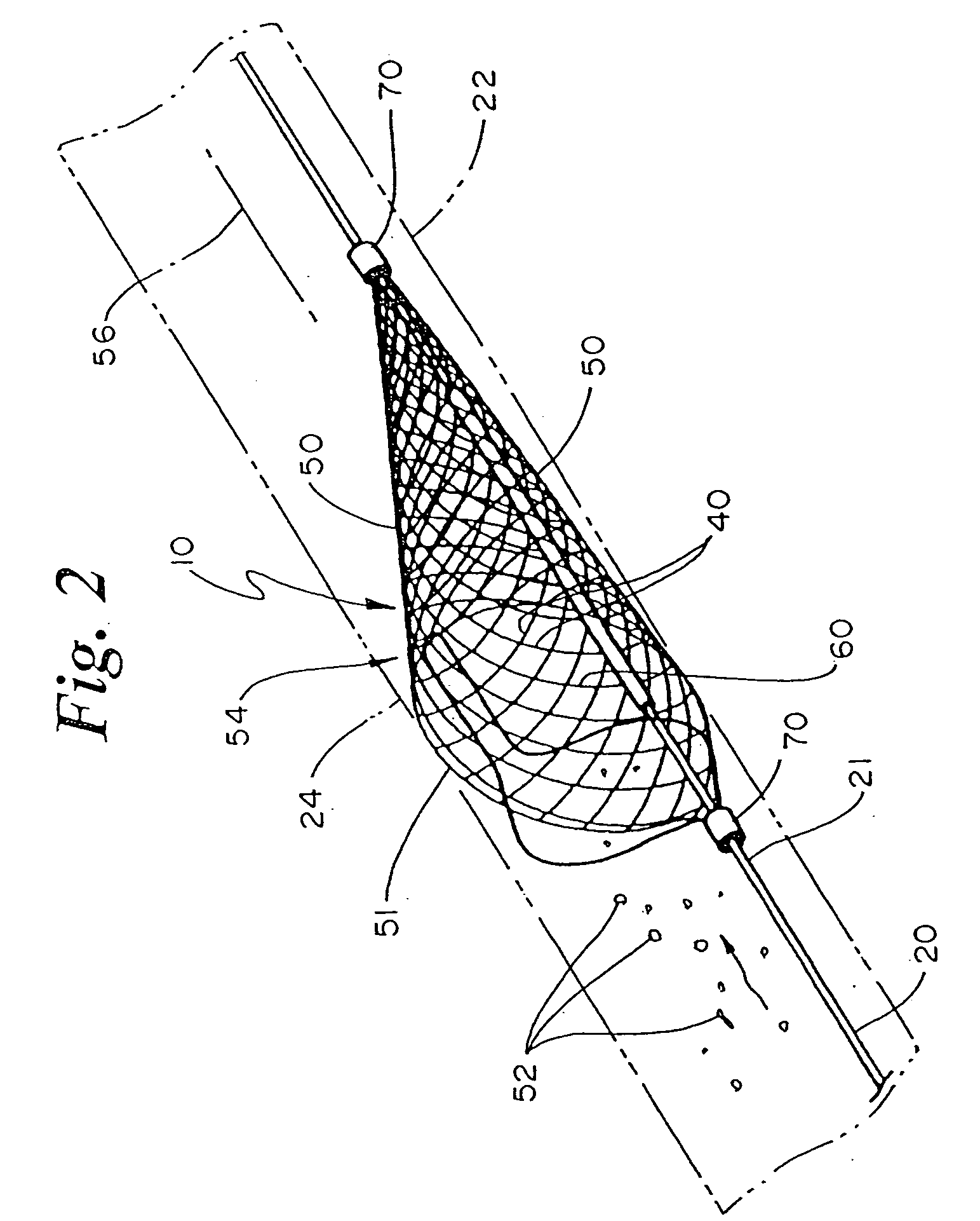 Radiopaque distal embolic protection device