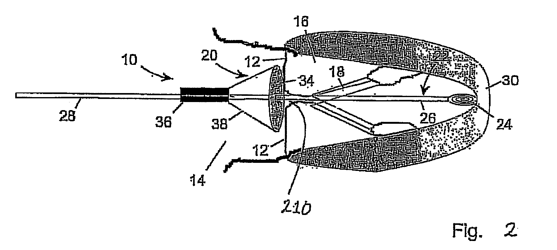 Medical device suitable for use in treatment of a valve