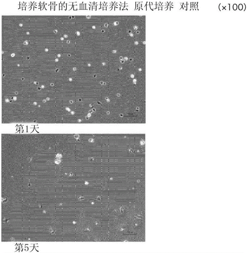 Method for serum-free culture of cartilage cells and serum-free culture medium