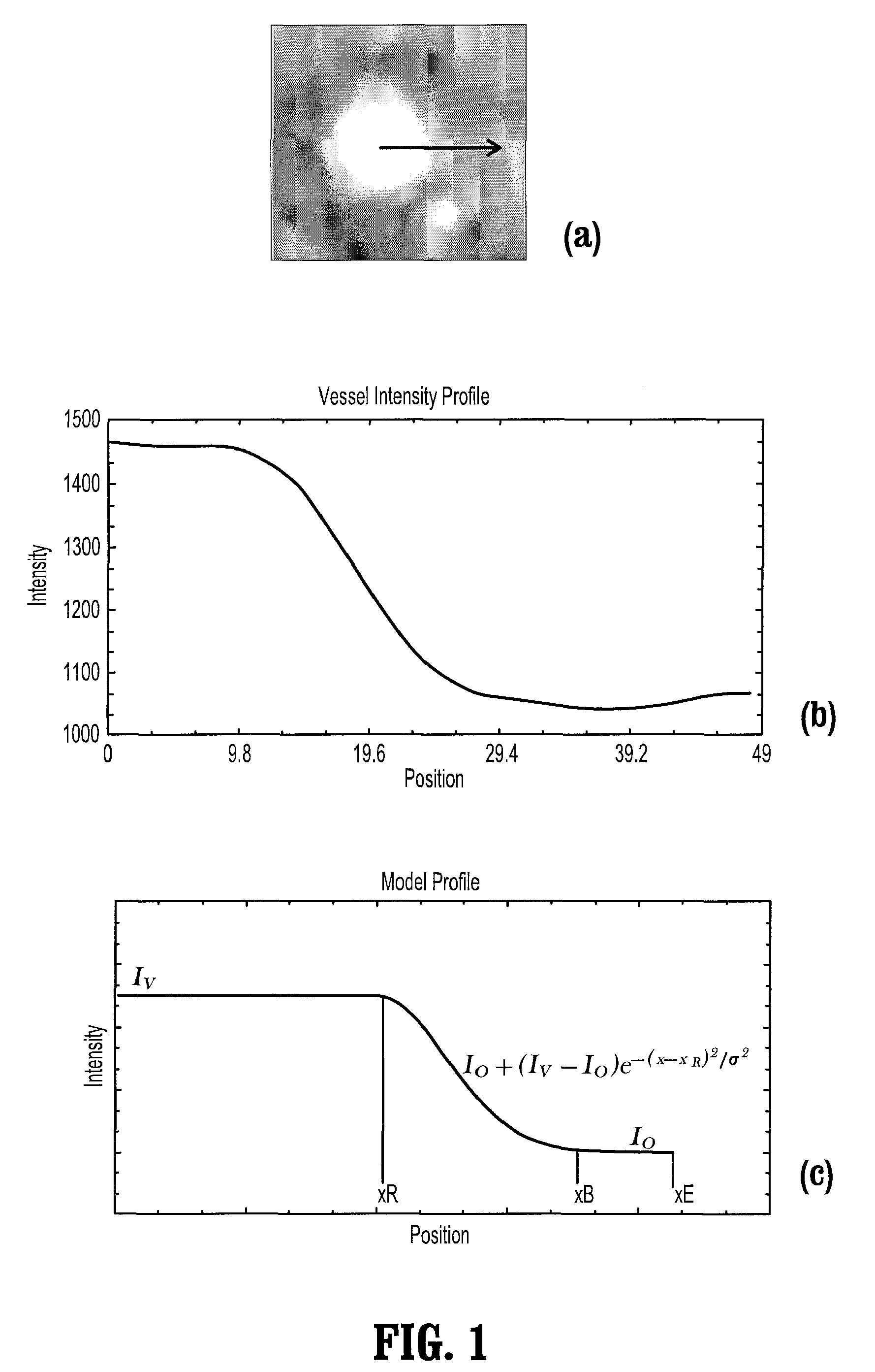 Robust vessel tree modeling