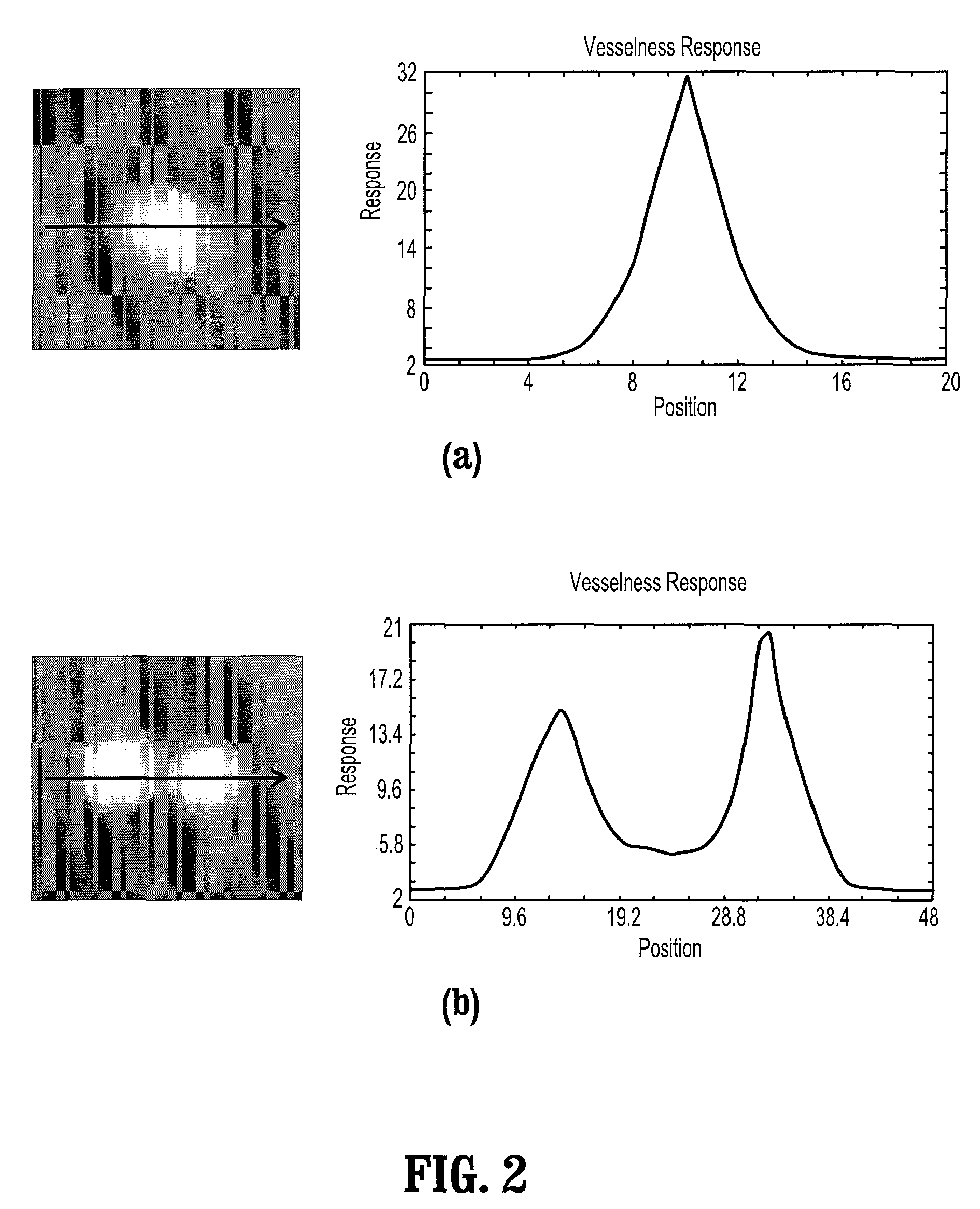 Robust vessel tree modeling