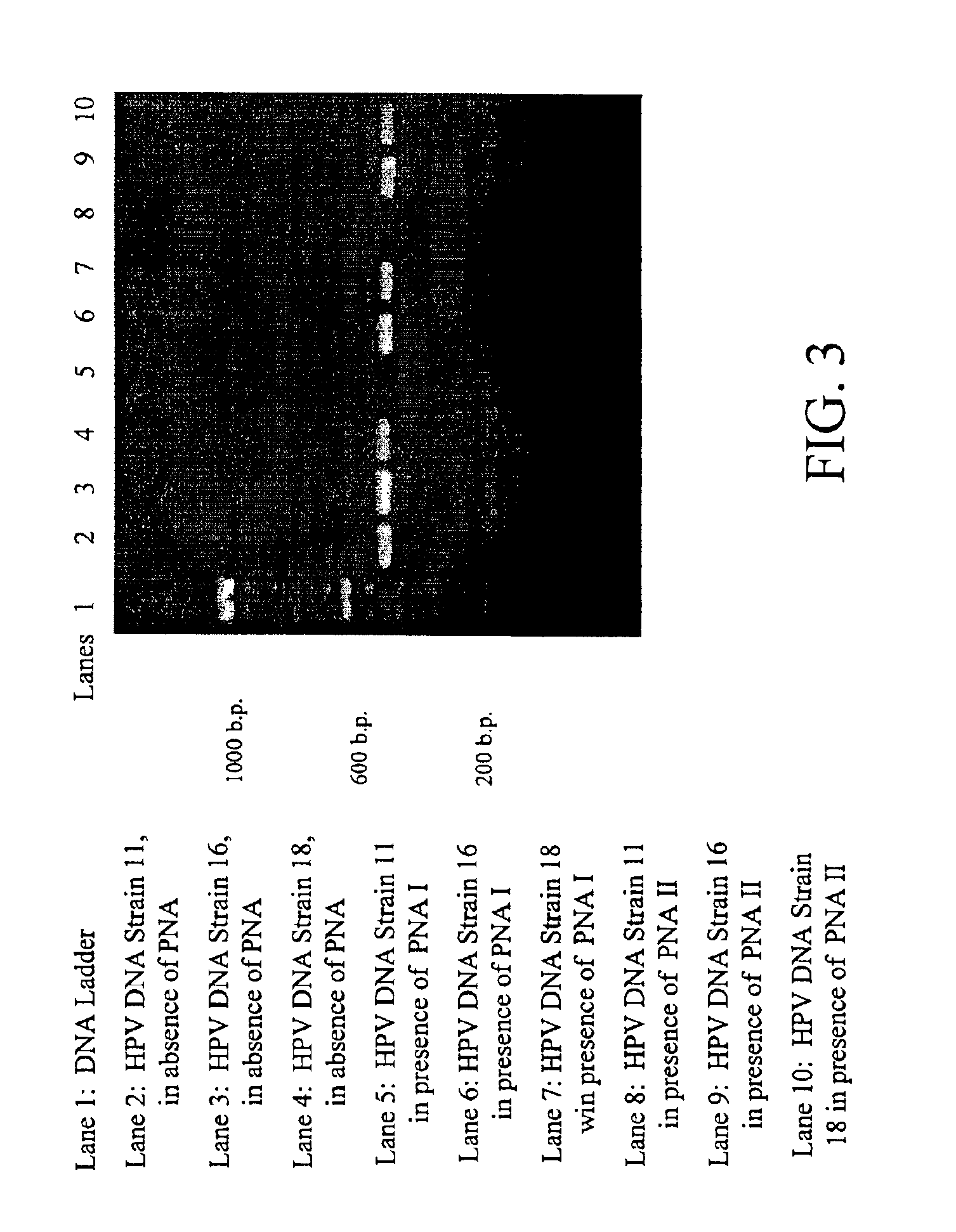 Detection and typing of human papillomavirus using PNA probes