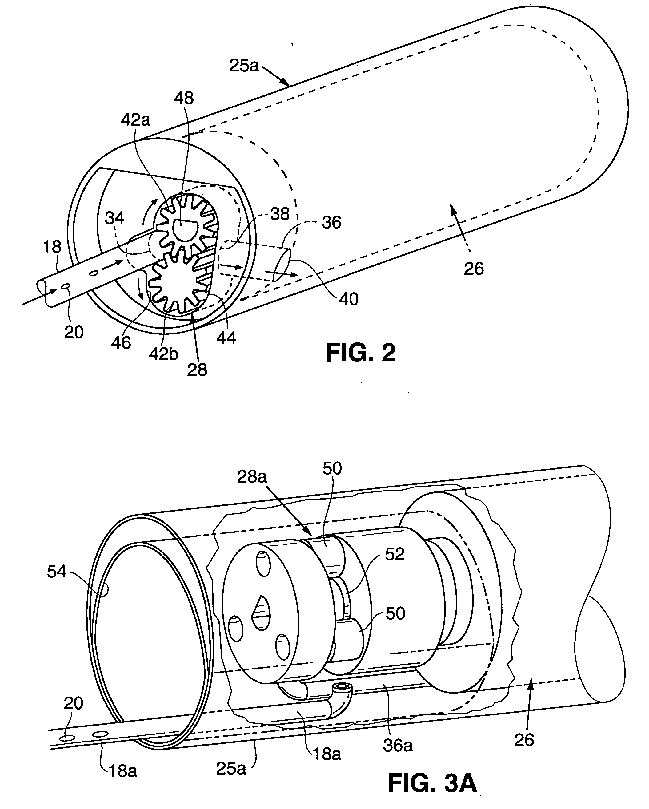 Intravascular delivery system for therapeutic agents