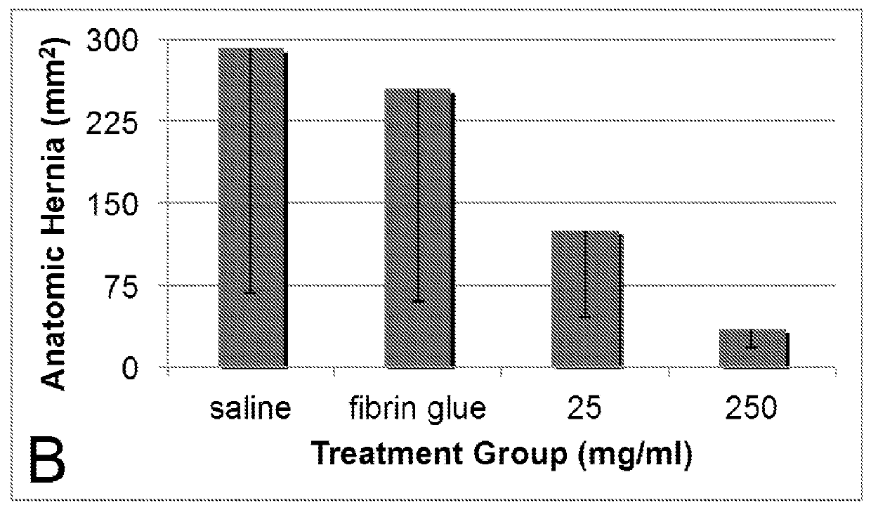 Methods and compositions for treating wounds and reducing the risk of incisional hernias