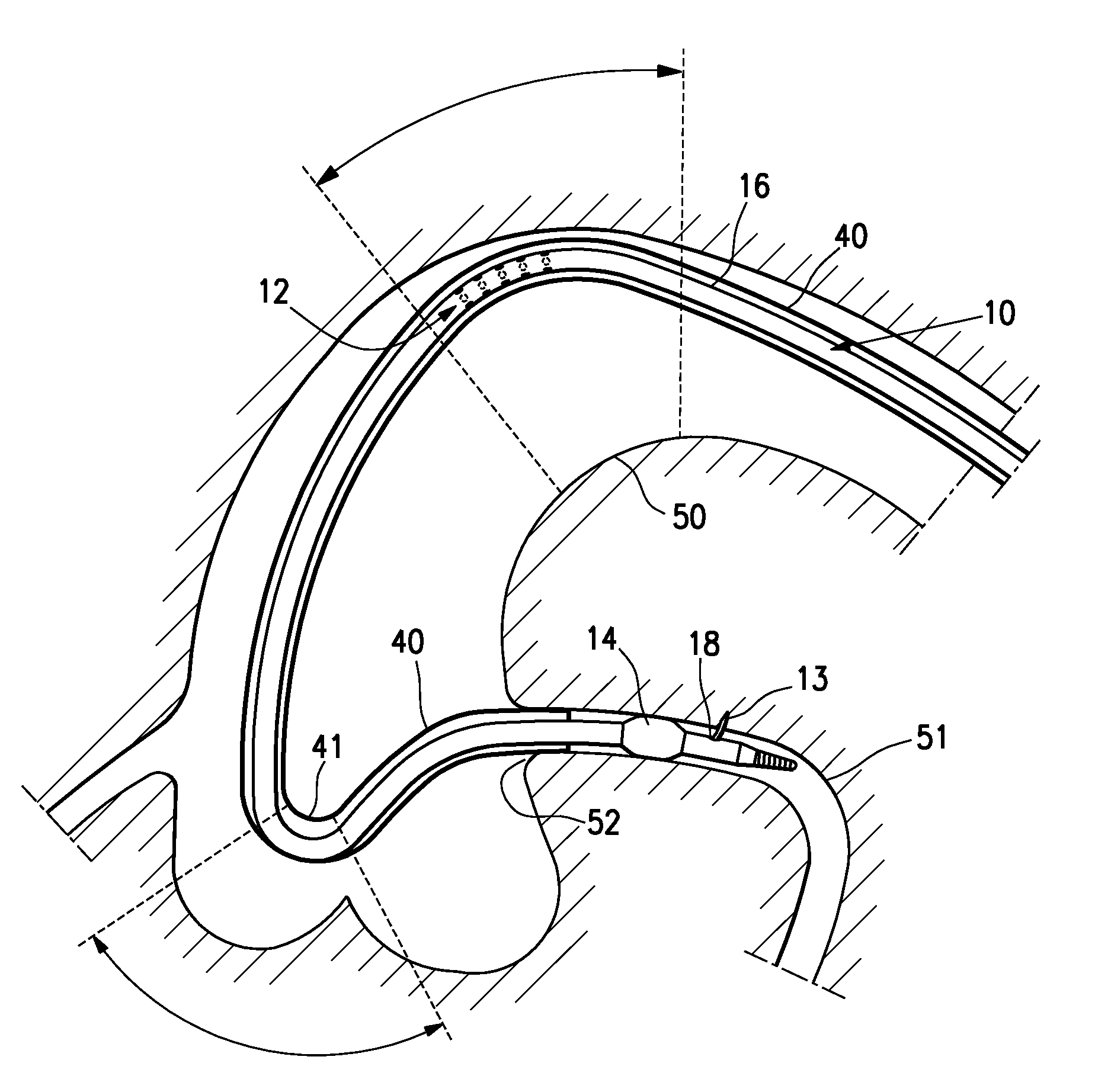 Catheter configured for incremental rotation