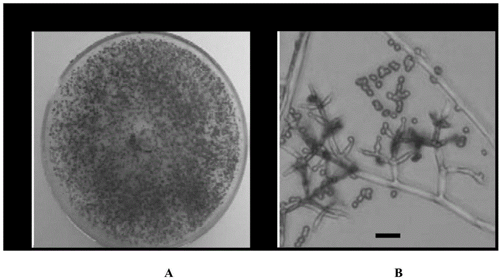 A rapeseed endogenous Trichoderma dark green retv2 strain and its preparation method and application