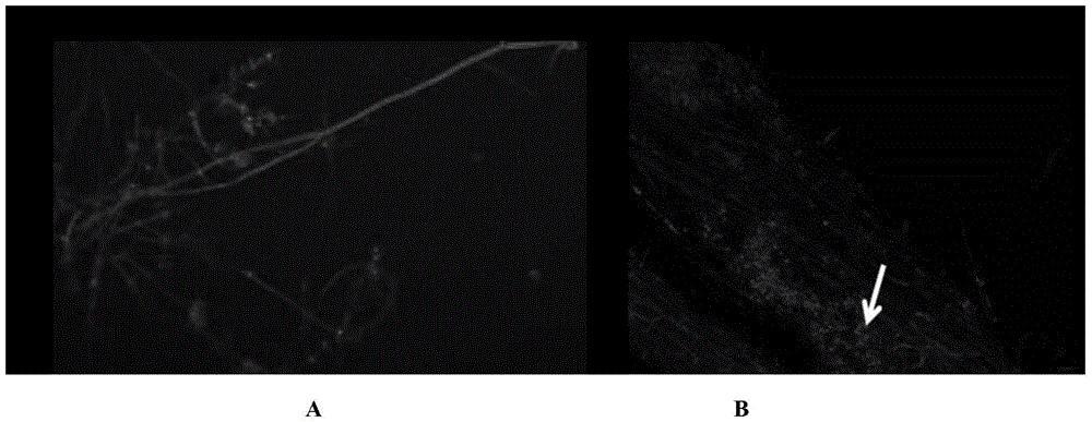 A rapeseed endogenous Trichoderma dark green retv2 strain and its preparation method and application