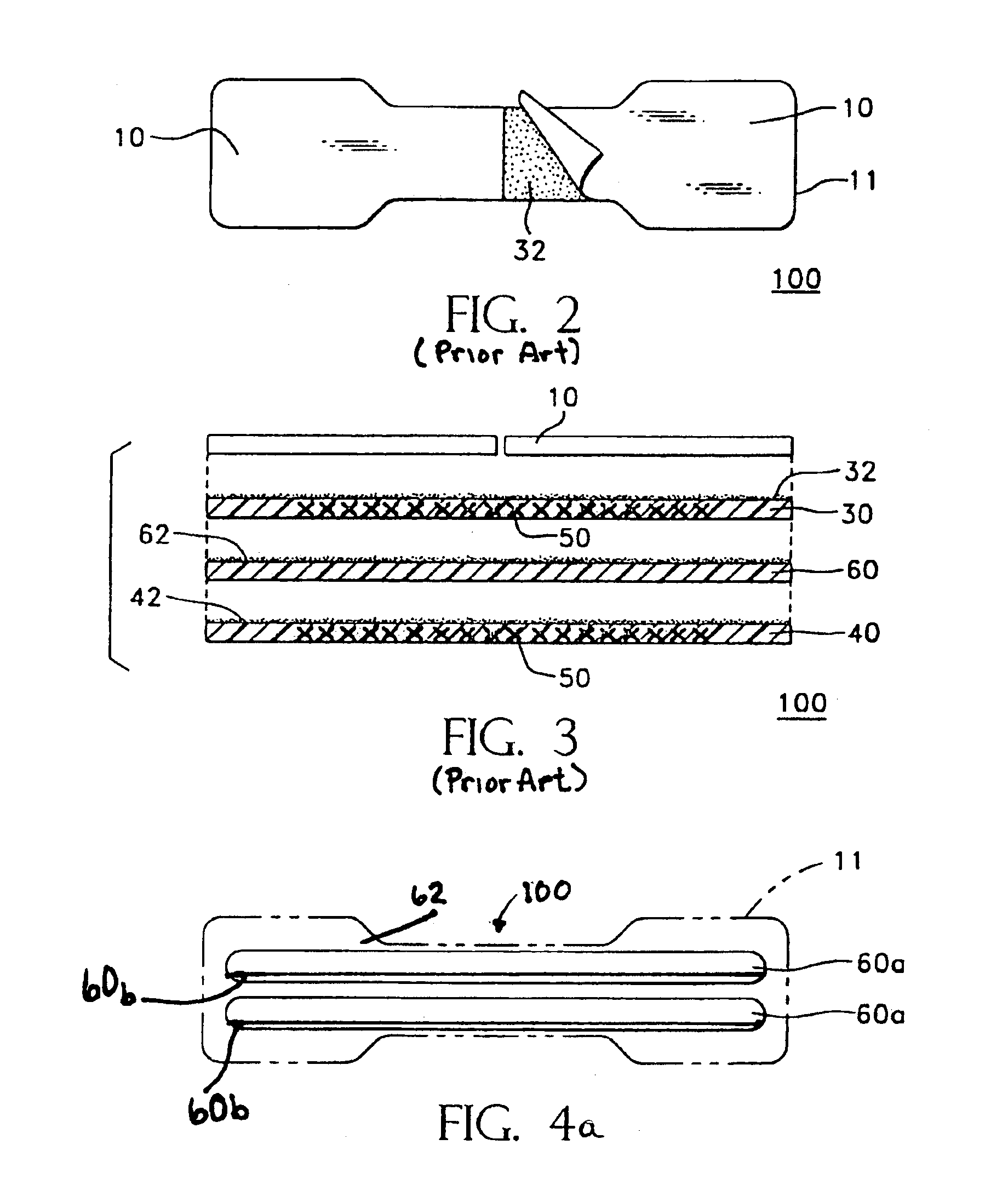 Method and structure for nasal dilator