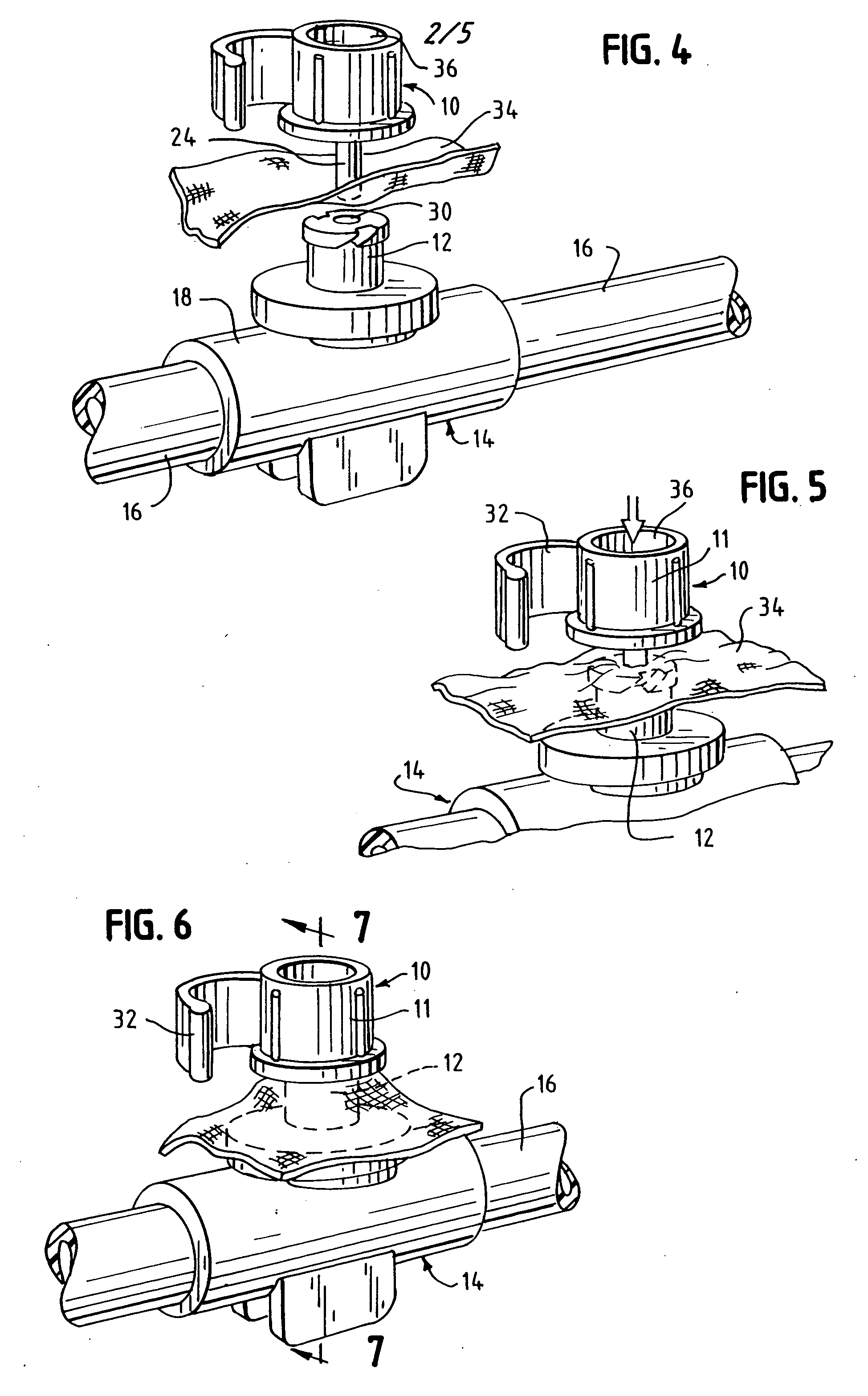 Closure for tubular access port